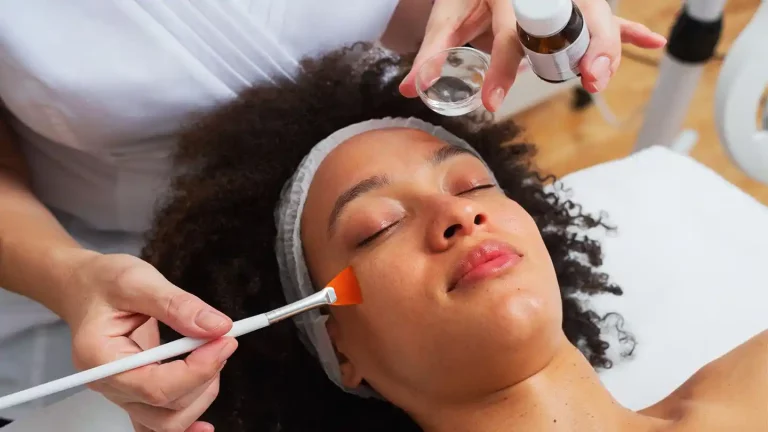 The Benefits of a Chemical Peel for Cosmetic Purposes